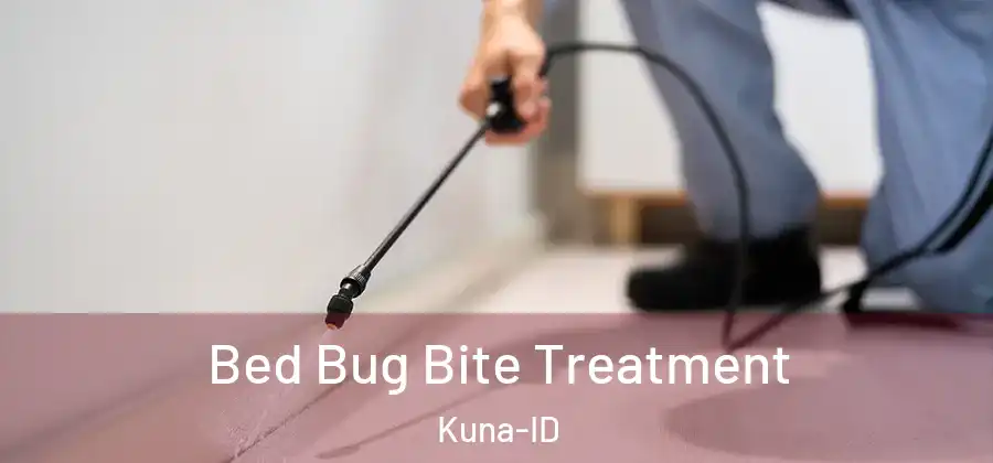 Bed Bug Bite Treatment Kuna-ID
